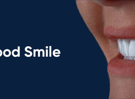 Select Dental Implant Costs in Turkey: Affordable Solutions for Restoring Your Smile Dental Implant Costs in Turkey: Affordable Solutions for Restoring Your Smile