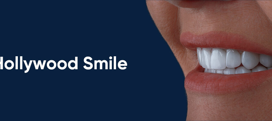Select Dental Implant Costs in Turkey: Affordable Solutions for Restoring Your Smile Dental Implant Costs in Turkey: Affordable Solutions for Restoring Your Smile