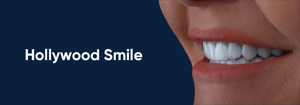 Select Dental Implant Costs in Turkey: Affordable Solutions for Restoring Your Smile Dental Implant Costs in Turkey: Affordable Solutions for Restoring Your Smile