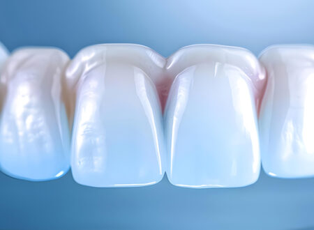 Digital Smile Design (DSD) in Turkey: Preview Your New Smile Before Treatment