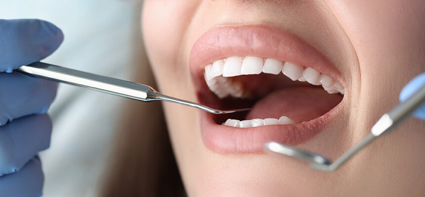 How Long Do Veneers Last? Porcelain & Zirconium Lifespan Guide (Turkey, 2025)