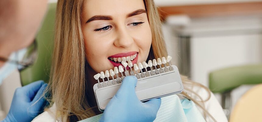 Hollywood Smile Cost in Turkey (2025) – What’s Included & Price Breakdown