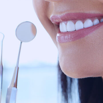 Smile Makeover in Turkey – Full Transformation with Veneers & Whitening (2025)