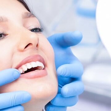 Hollywood Smile for Women in Turkey – Feminine Smile Design & Cost (2025)