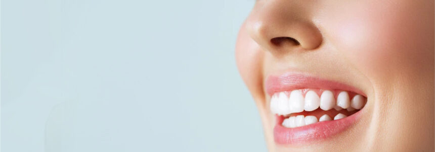 Porcelain Veneers in Turkey – Cost, Pros & Results (2025 Guide)