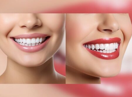 Comprehensive Guide to Dental Implant Surgery in Turkey 2025: Techniques, Costs, Risks, and Top Clinics