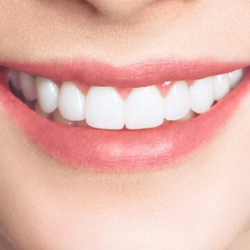 Hollywood Smile for Men in Turkey – Masculine Smile Design & Cost (2025)