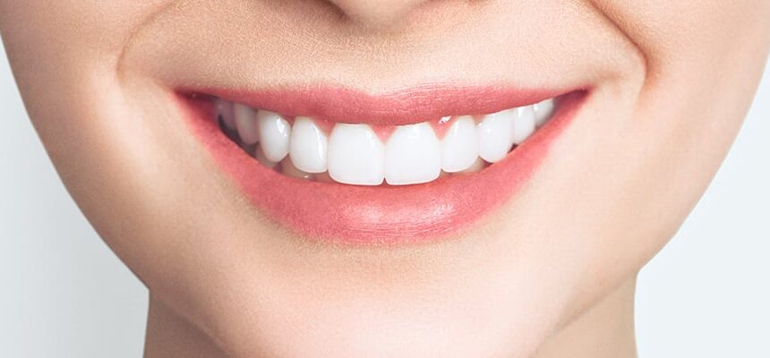 Hollywood Smile for Men in Turkey – Masculine Smile Design & Cost (2025)