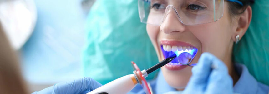 Dental Veneers in Turkey – Types, Cost & Procedure (2025 Guide)
