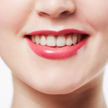 photo_11_2025-09-16_12-31-29 hollywood smile vs veneers