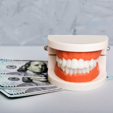 closeup-model-of-a-human-jaw-with-white-teeth-and-2025-03-10-14-48-15-utc Hollywood Smile Cost in Turkey