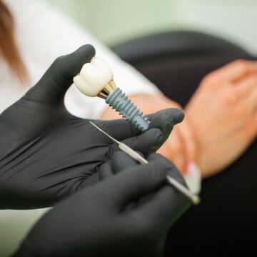 dentist-explaining-teeth-model-to-female-patient-2025-02-12-19-22-19-utc best dental implant brands turkey