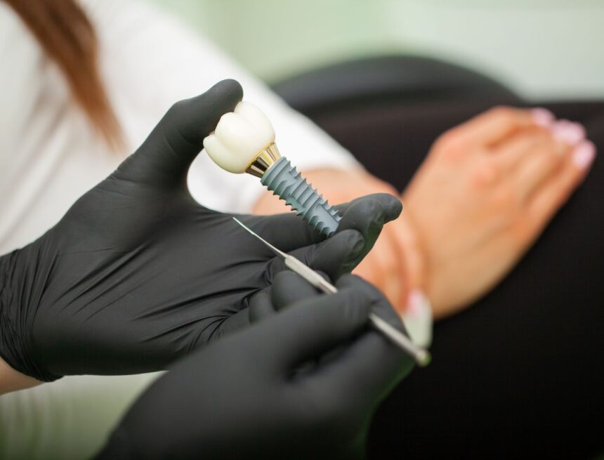 dentist-explaining-teeth-model-to-female-patient-2025-02-12-19-22-19-utc best dental implant brands turkey