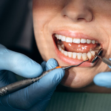 photo_15_2025-09-16_14-40-35 smile design turkey