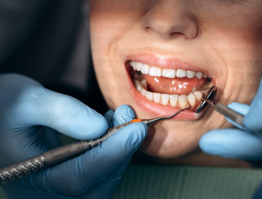 photo_15_2025-09-16_14-40-35 smile design turkey