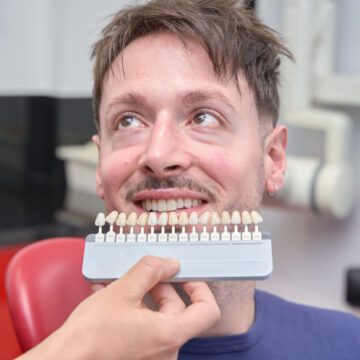 photo_2025-09-15_17-06-02 hollywood smile for men turkey