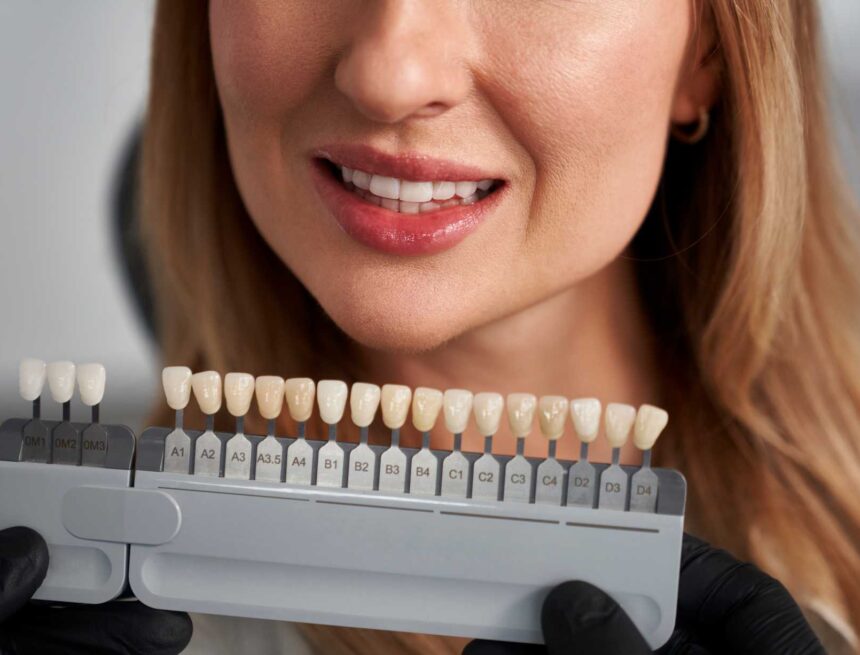 woman-having-cosmetic-dentistry-at-dentist-s-offic-2024-11-27-15-35-15-utc (2) porcelain veneers Turkey